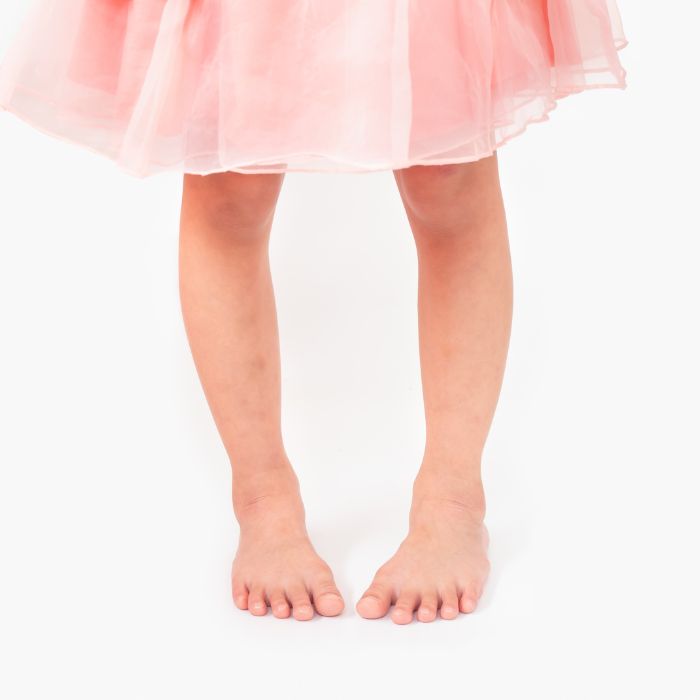 Close-up of a child's bare feet and legs in a standing position, with slight inward alignment. This image relates to Progressive GaitWays' Pediatric In-Toeing and Out-Toeing Management for Neuromotor Training course, which teaches clinicians to identify and address gait deviations, improving alignment and functional motor skills in children.